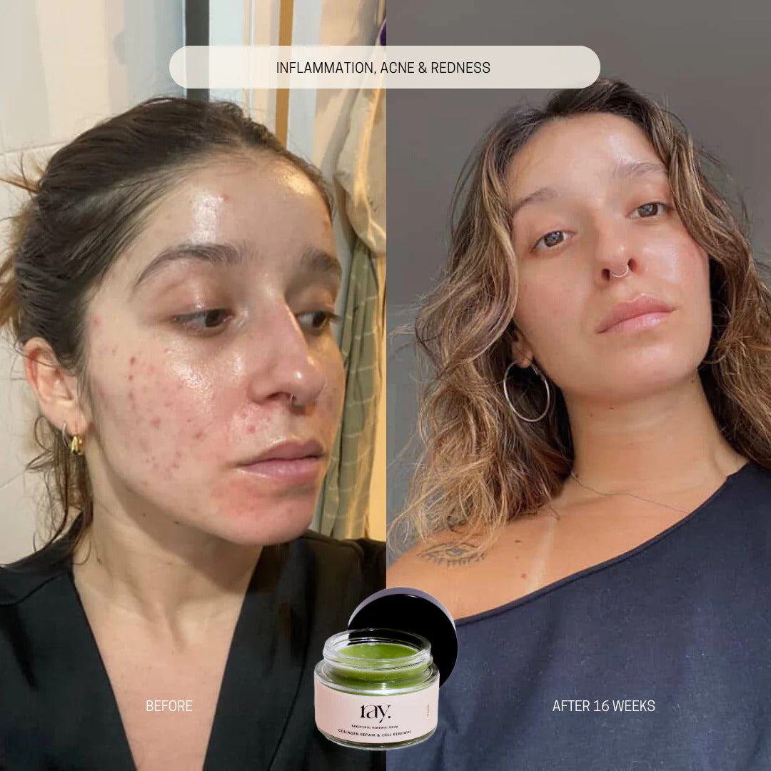 Bakuchiol Renewal Balm results 2