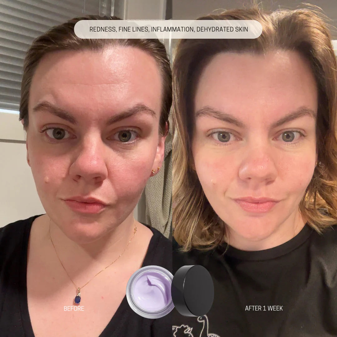 Bilberry Face Cream results
