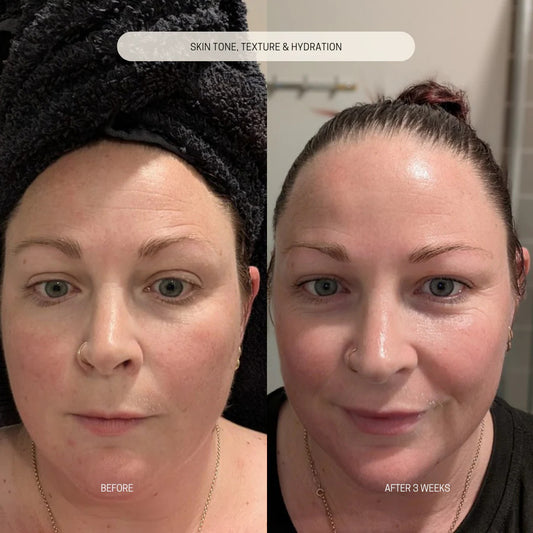 Vitamin Elixir Face Oil results