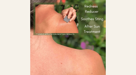 Your Skin’s Best Friend After Sun: A Deep Dive into Dew Mighty Jelly Bloom