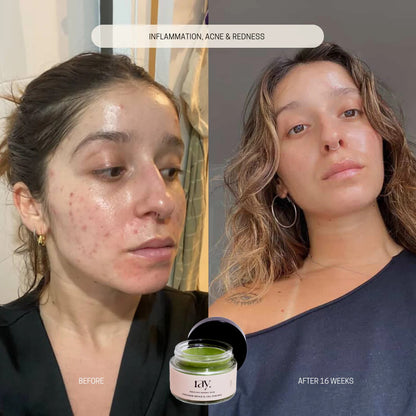 Bakuchiol Renewal Balm results 2