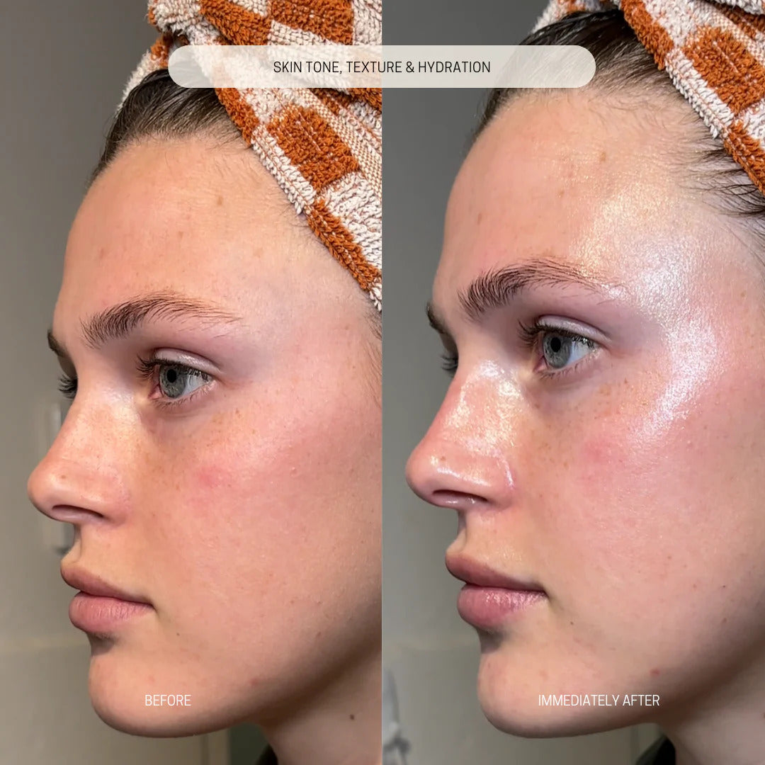 Bakuchiol Renewal Balm results