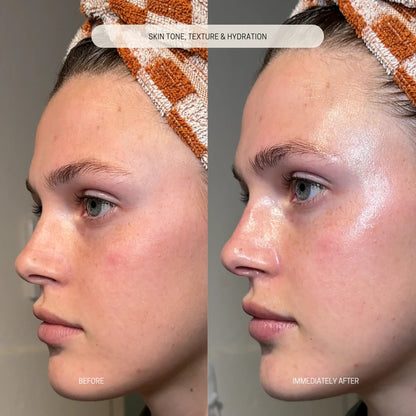 Bakuchiol Renewal Balm results
