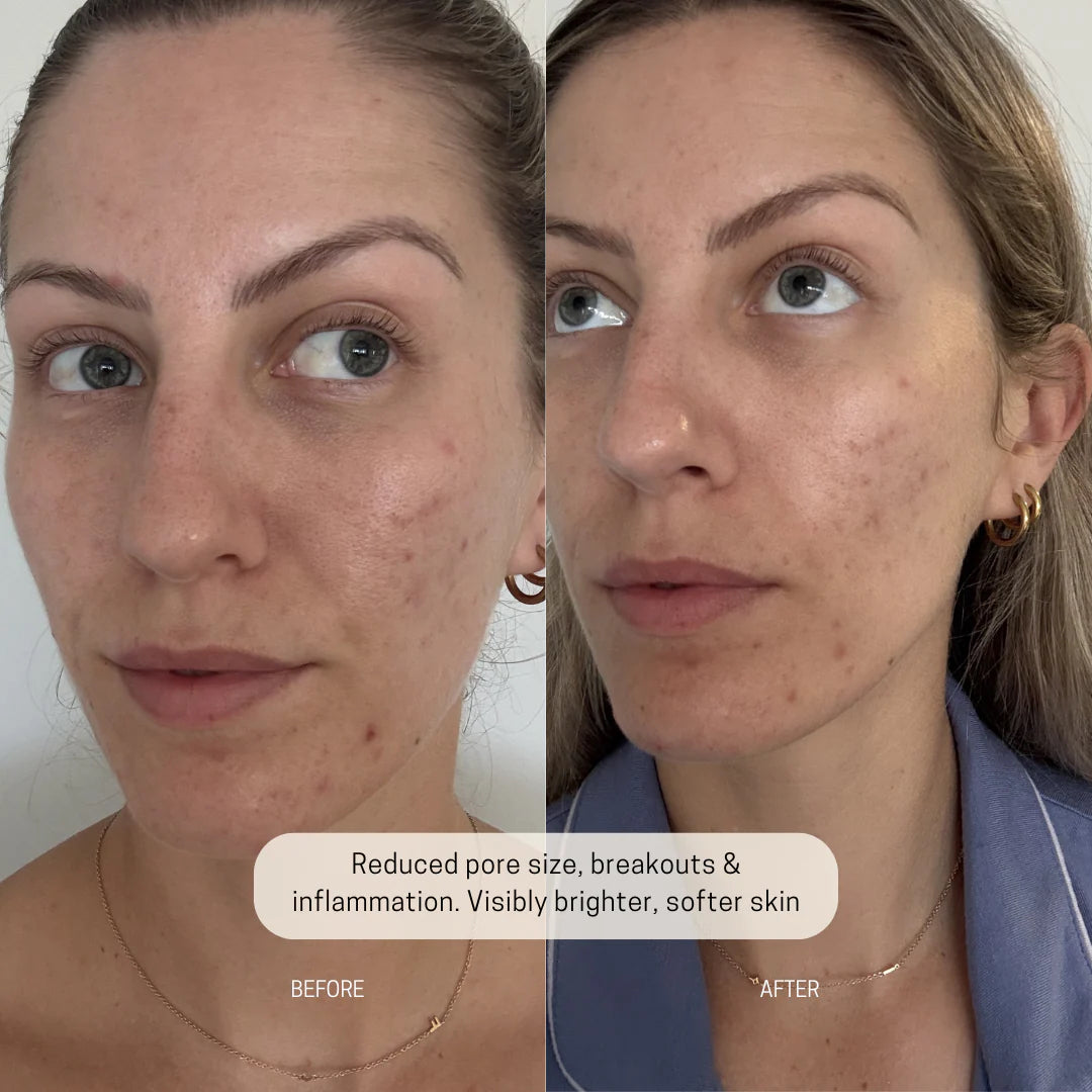 Herbal Cleanser reults